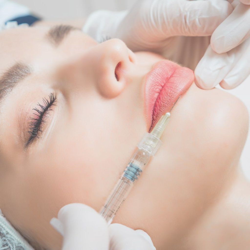 Medicina estetica 1 filler labbra a Novi Ligure
