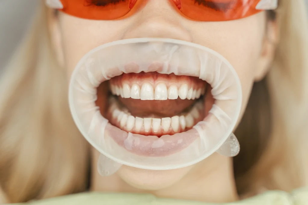 Guida completa all’odontoiatria estetica: il glossario per capire davvero i trattamenti del sorriso 1 Odontoiatria estetica