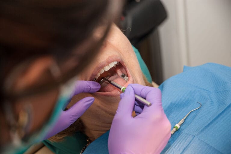 Dente che si muove