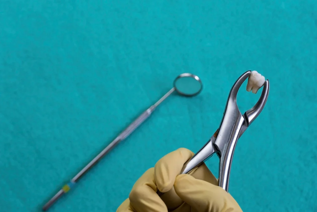togliere un dente del giudizio