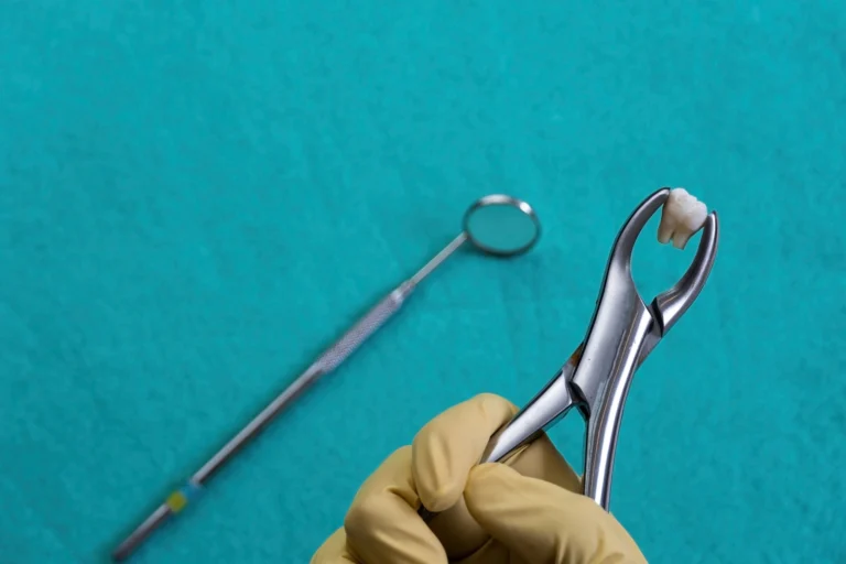 togliere un dente del giudizio
