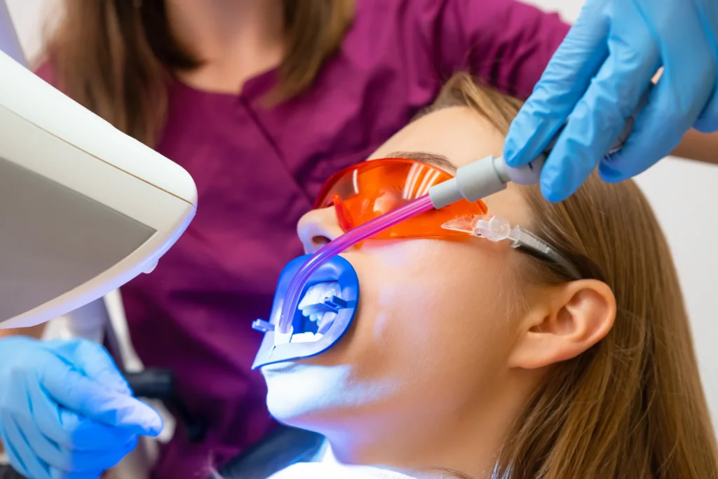 sbiancamento dentale dal dentista