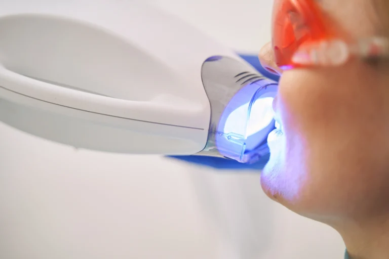 sbiancamento dentale dal dentista