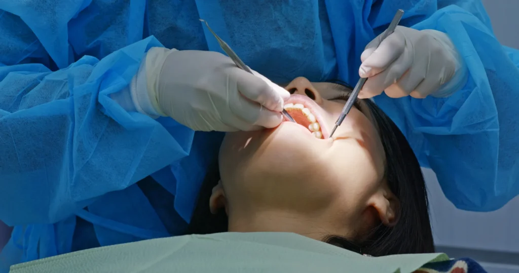 togliere un dente del giudizio